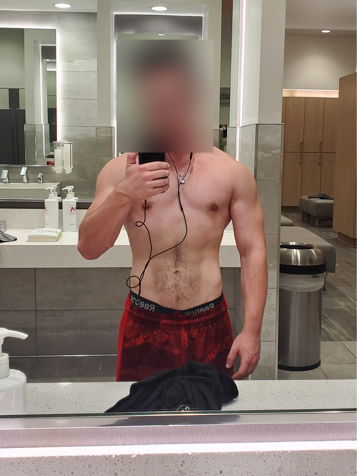  (before)